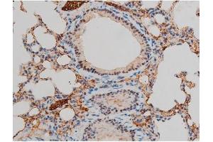 Image no. 4 for anti-GATA Binding Protein 1 (Globin Transcription Factor 1) (GATA1) (pSer142) antibody (ABIN6254982)