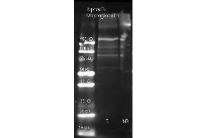 Image no. 1 for anti-alpha-2-Macroglobulin (A2M) antibody (ABIN103762)