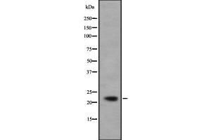 Image no. 2 for anti-Interferon, alpha 5 (IFNA5) antibody (ABIN6262467)