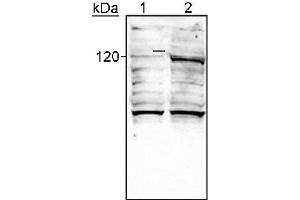 Image no. 4 for anti-Endothelial PAS Domain Protein 1 (EPAS1) (AA 535-631) antibody (ABIN363209)