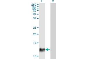 Image no. 1 for anti-Hepatitis B Virus X-Interacting Protein (HBXIP) (AA 83-173) antibody (ABIN523960)