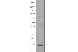Image no. 1 for anti-Prefoldin Subunit 1 (PFDN1) (Internal Region) antibody (ABIN6257796)