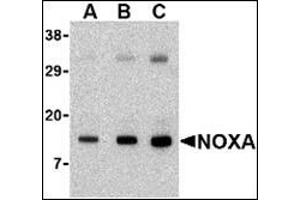 anti-Phorbol-12-Myristate-13-Acetate-Induced Protein 1 (PMAIP1) (N-Term) antibody