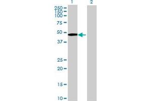 Image no. 1 for anti-Melanoma Antigen Family A, 11 (MAGEA11) (AA 1-319) antibody (ABIN517704)