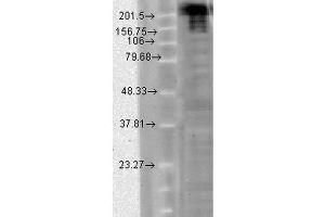 Western Blot analysis of hamster CHO cells showing detection of Nav1.