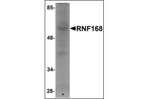 Image no. 1 for anti-Ring Finger Protein 168 (RNF168) (C-Term) antibody (ABIN500624)