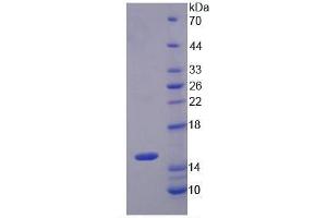 Image no. 6 for S100 Calcium Binding Protein A8 (S100A8) ELISA Kit (ABIN6574287)