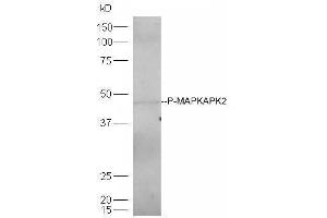 Image no. 3 for anti-Mitogen-Activated Protein Kinase-Activated Protein Kinase 2 (MAPKAPK2) (pThr334) antibody (ABIN743693)