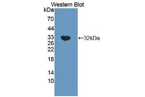 Image no. 1 for anti-Cathepsin A (CTSA) (AA 171-417) antibody (ABIN5013305)