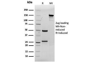 Image no. 1 for anti-Caudal Type Homeobox 2 (CDX2) (AA 150-249) antibody (ABIN6939059)