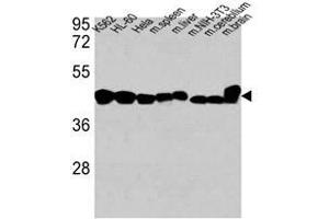 Image no. 1 for anti-Actin, beta (ACTB) antibody (ABIN658990)