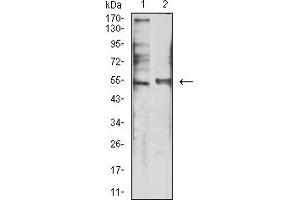 Image no. 5 for anti-Serotonin Receptor 3B (HTR3B) (AA 23-150) antibody (ABIN5611118)
