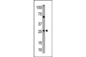 Image no. 1 for anti-BCL2/adenovirus E1B 19kDa Interacting Protein 1 (BNIP1) (AA 92-127) antibody (ABIN388111)