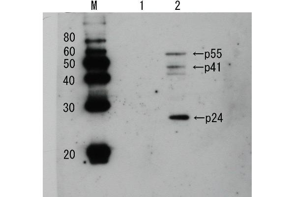 HIV-1 p24 anticorps  (Biotin)