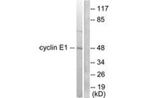 Image no. 1 for anti-Cyclin E1 (CCNE1) (AA 91-140) antibody (ABIN1533249)