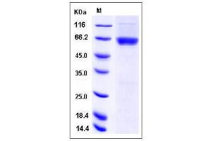 Image no. 1 for Casein Kinase 2 alpha 1 (CSNK2A1) (AA 1-391) (Active) protein (GST tag) (ABIN2003163)
