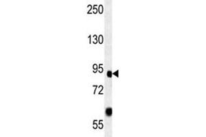Image no. 1 for anti-Forkhead Box P2 (FOXP2) (AA 657-684) antibody (ABIN3030995)