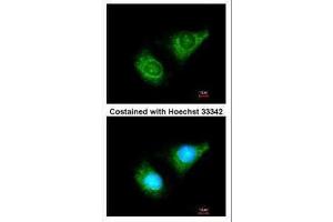 Image no. 1 for anti-Caspase 8 (CASP8) (Center) antibody (ABIN2854891)