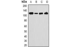 Image no. 1 for anti-Ankyrin Repeat Domain 28 (ANKRD28) antibody (ABIN3197883)