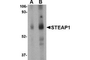 Western Blotting (WB) image for anti-Six Transmembrane Epithelial Antigen of The Prostate 1 (STEAP1) (Middle Region) antibody (ABIN1031108)