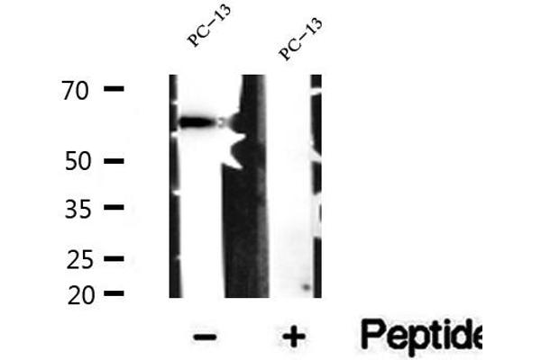 anti-Spermine Oxidase (SMOX) (Internal Region) antibody