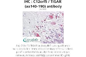 Image no. 1 for anti-TP53 induced glycolysis regulatory phosphatase (TIGAR) (AA 140-190) antibody (ABIN1732472)