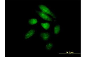 Image no. 2 for anti-Period Homolog 1 (Drosophila) (PER1) (AA 1-1290) antibody (ABIN518783)
