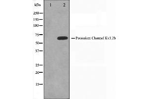 Image no. 1 for anti-Potassium Voltage-Gated Channel, Shaw-Related Subfamily, Member 2 (KCNC2) (C-Term) antibody (ABIN6262739)