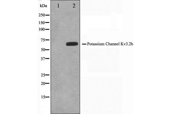 KCNC2 antibody  (C-Term)