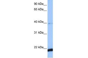 Image no. 1 for anti-HBS1-Like (HBS1L) (C-Term) antibody (ABIN2784826)