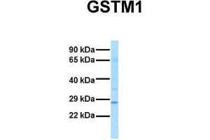 Image no. 2 for anti-Glutathione S-Transferase mu 1 (GSTM1) (N-Term) antibody (ABIN2776984)