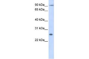 Image no. 1 for anti-Tetraspanin 31 (TSPAN31) (Middle Region) antibody (ABIN2782698)