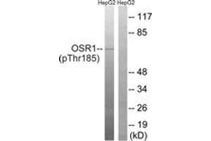 Image no. 1 for anti-Odd-Skipped Related 1 (OSR1) (AA 151-200), (pThr185) antibody (ABIN1532067)
