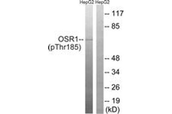 anti-Odd-Skipped Related 1 (OSR1) (AA 151-200), (pThr185) antibody