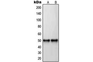 Image no. 1 for anti-Retinoic Acid Receptor, beta (RARB) (C-Term) antibody (ABIN2705172)