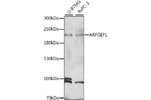 ARFGEF1 Antikörper  (AA 220-420)