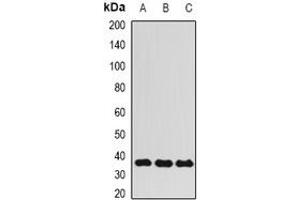 Image no. 1 for anti-AlkB, Alkylation Repair Homolog 3 (ALKBH3) (full length) antibody (ABIN6043154)