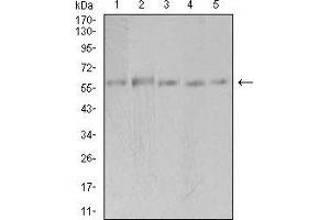 PAK3 antibody  (AA 1-100)
