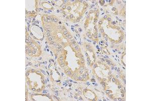 Immunohistochemistry of paraffin-embedded human kidney using DCTN2 antibody at dilution of 1:200 (x400 lens)