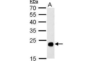Image no. 4 for anti-Glutathione S-Transferase theta 1 (GSTT1) (full length) antibody (ABIN2856663)