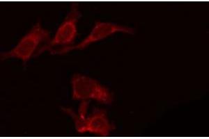 Image no. 3 for anti-Patched 1 (PTCH1) (N-Term) antibody (ABIN6264046)