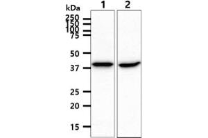 Image no. 2 for anti-Acyl-CoA Dehydrogenase, C-2 To C-3 Short Chain (Acads) antibody (ABIN5776017)