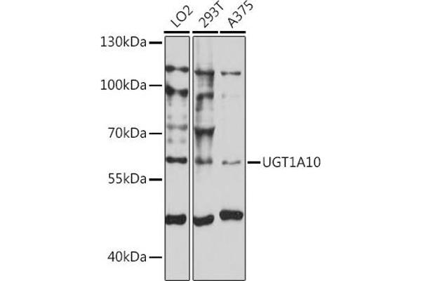 UGT1A10 anticorps  (AA 50-150)
