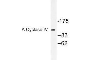 Image no. 1 for anti-Adenylate Cyclase 4 (ADCY4) antibody (ABIN317941)