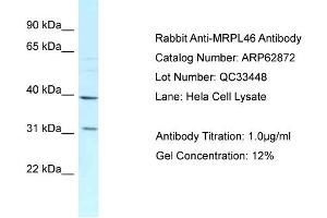 Image no. 1 for anti-Mitochondrial Ribosomal Protein L46 (MRPL46) (C-Term) antibody (ABIN2789278)