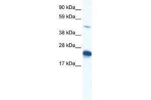 Image no. 1 for anti-Zinc Finger Protein 57 Homolog (ZFP57) (N-Term) antibody (ABIN927349)
