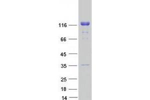 Image no. 1 for Ligase I, DNA, ATP-Dependent (LIG1) protein (Myc-DYKDDDDK Tag) (ABIN2719545)