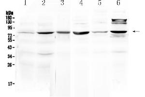 Image no. 3 for anti-Hydroxysteroid (17-Beta) Dehydrogenase 4 (HSD17B4) (AA 510-736) antibody (ABIN5518845)