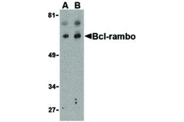 anti-BCL2-Like 13 (Apoptosis Facilitator) (BCL2L13) (Internal Region) antibody