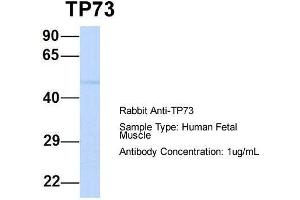 Image no. 2 for anti-Tumor Protein P73 (TP73) (N-Term) antibody (ABIN2777952)